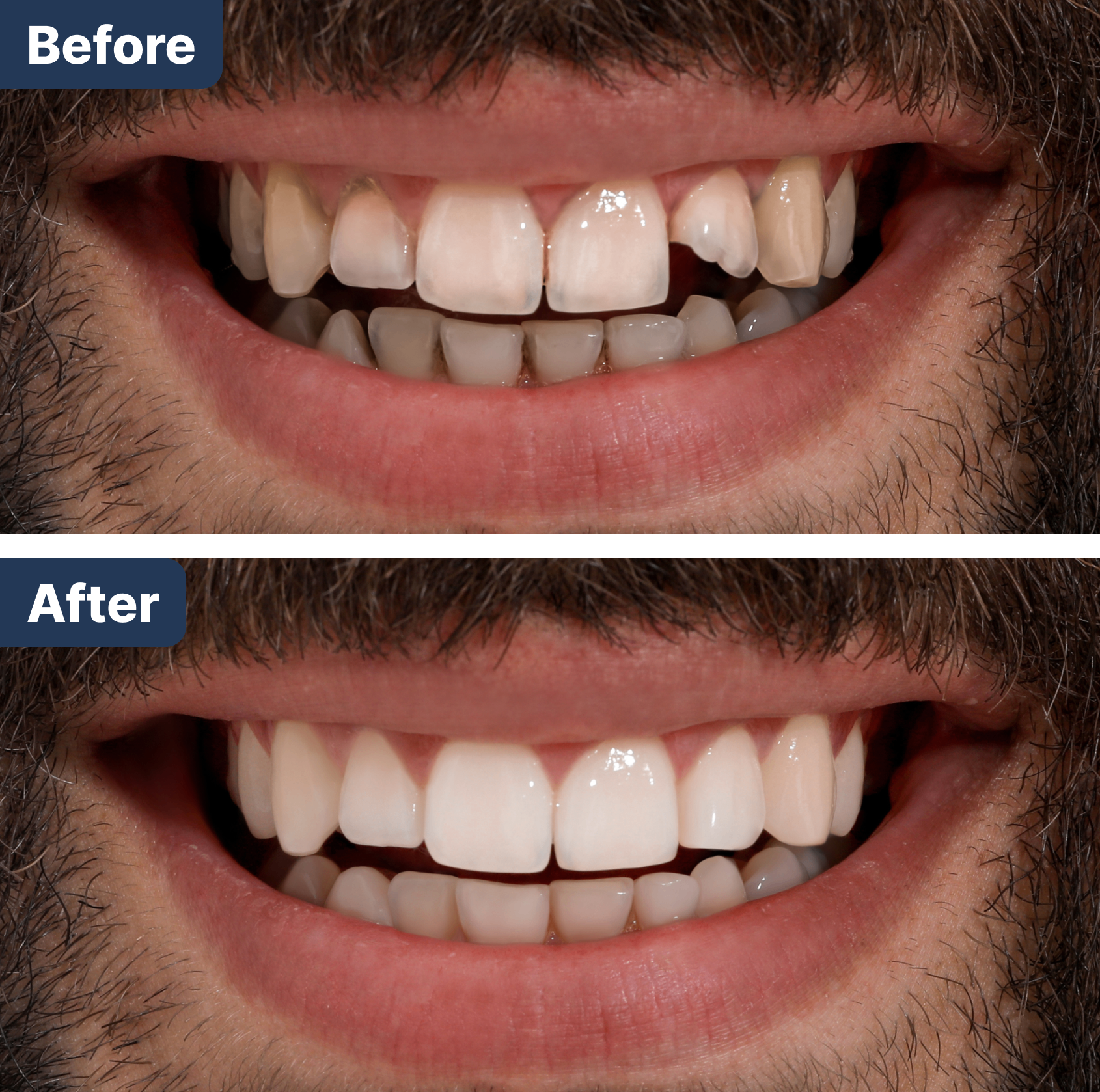 Before and After Treatment